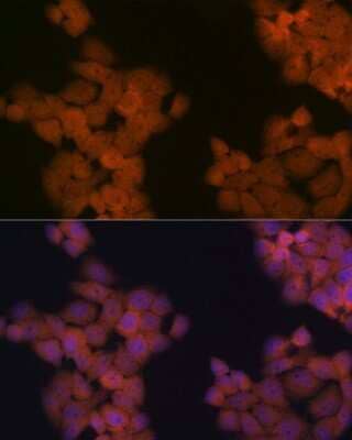 Immunocytochemistry/ Immunofluorescence: Cdc23 Antibody (1Q2I3) [NBP3-16631]