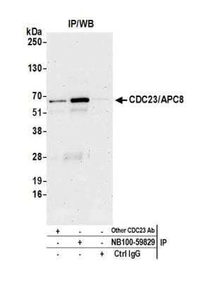 Immunoprecipitation: Cdc23 Antibody [NB100-59829]