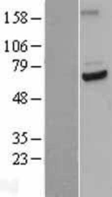 Western Blot: Cdc23 Overexpression Lysate [NBL1-08993]