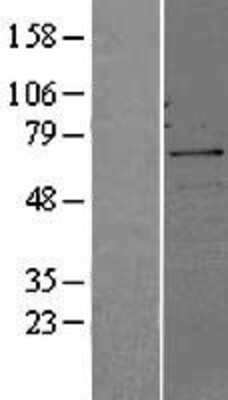 Western Blot: CDC25B Overexpression Lysate [NBL1-08995]