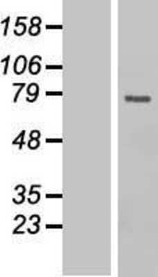 Western Blot: CDC25B Overexpression Lysate [NBP2-06512]