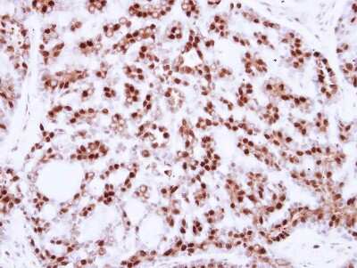 Immunohistochemistry-Paraffin: CDC25C Antibody [NBP2-15827]