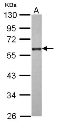 Western Blot: CDC25C Antibody [NBP2-15827]