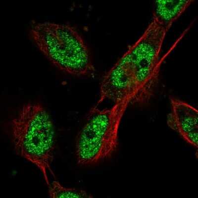 Immunocytochemistry/ Immunofluorescence: Cdc27 Antibody [NBP2-56172]