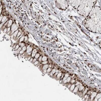 Immunohistochemistry-Paraffin: Cdc27 Antibody [NBP1-89095]