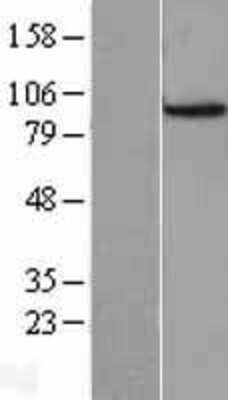 Western Blot: Cdc27 Overexpression Lysate [NBL1-08998]