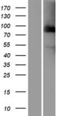 Western Blot: Cdc27 Overexpression Lysate [NBP2-09390]