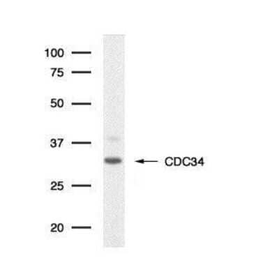 Western Blot: UBE2R1/CDC34 Antibody (90.12) [NB500-110]