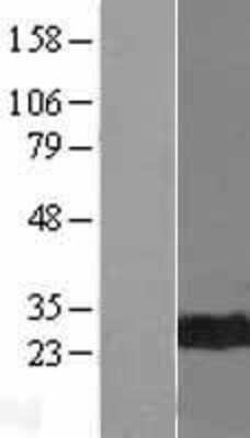 Western Blot: UBE2R1/CDC34 Overexpression Lysate [NBL1-09001]