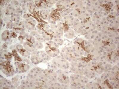 Immunohistochemistry: Cdc6 Antibody (OTI1A4) [NBP2-46192]