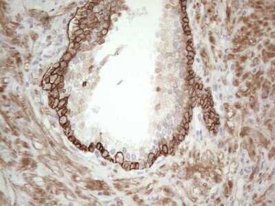 Immunohistochemistry: Cdc6 Antibody (OTI1A4) [NBP2-46192]