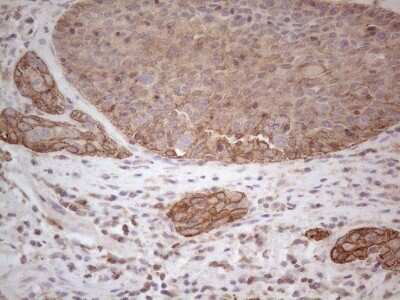 Immunohistochemistry: Cdc6 Antibody (OTI1A4) [NBP2-46192]