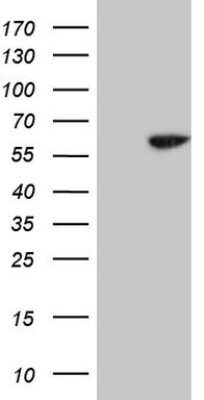 Western Blot: Cdc6 Antibody (OTI1A4) [NBP2-46192]