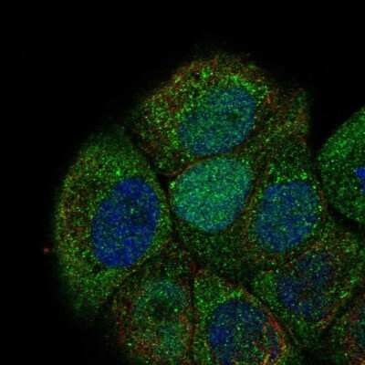 Immunocytochemistry/ Immunofluorescence: Cdc6 Antibody [NBP2-68827]