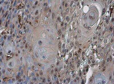 Immunohistochemistry-Paraffin: Cdc6 Antibody [NBP2-15837]