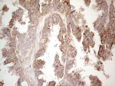 Immunohistochemistry: Cdc6 Antibody (OTI1A4) - Azide and BSA Free [NBP2-70383]