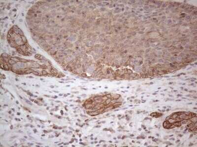 Immunohistochemistry: Cdc6 Antibody (OTI1A4) - Azide and BSA Free [NBP2-70383]