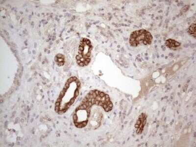 Immunohistochemistry: Cdc6 Antibody (OTI1A4) - Azide and BSA Free [NBP2-70383]