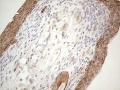Immunohistochemistry: Cdc6 Antibody (OTI1A4) - Azide and BSA Free [NBP2-70383]