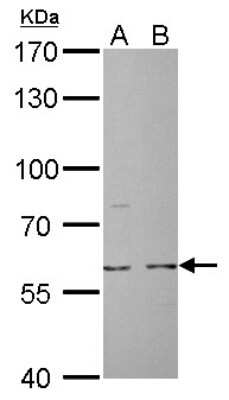 Western Blot: Cdc6 Antibody [NBP2-15837]