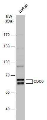 Western Blot: Cdc6 Antibody [NBP2-15837]