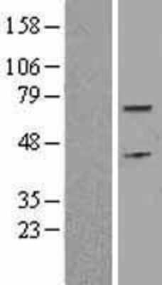 Western Blot: Cdc6 Overexpression Lysate [NBL1-09014]