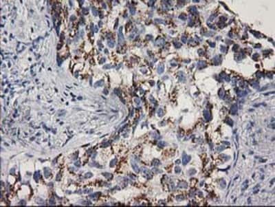 Immunohistochemistry-Paraffin: CDK2 Antibody (OTI2D9) [NBP2-00776]