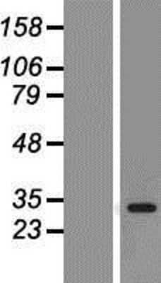 Western Blot: CDK2 Overexpression Lysate [NBP2-08176]