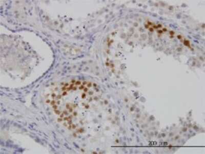 Immunohistochemistry-Paraffin: Cdk3 Antibody (3C12) [H00001018-M01]