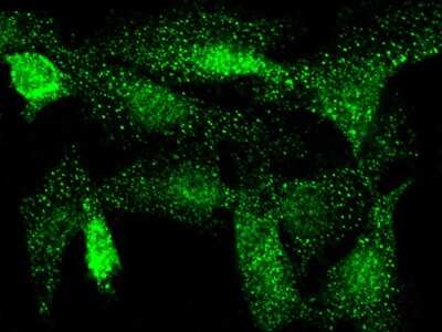 Immunocytochemistry/ Immunofluorescence: Cdk3 Antibody [NBP2-98989]