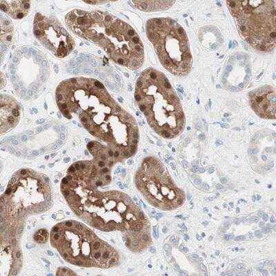 Immunohistochemistry-Paraffin: Cdk3 Antibody [NBP1-86496]