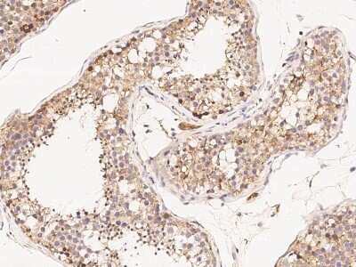 Immunohistochemistry-Paraffin: Cdk3 Antibody [NBP2-98989]