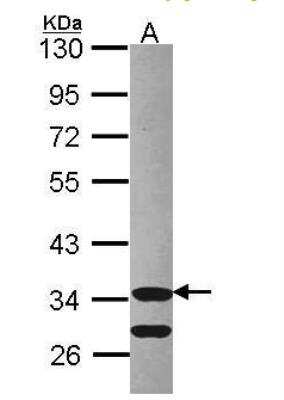 Western Blot: Cdk3 Antibody [NBP1-32230]