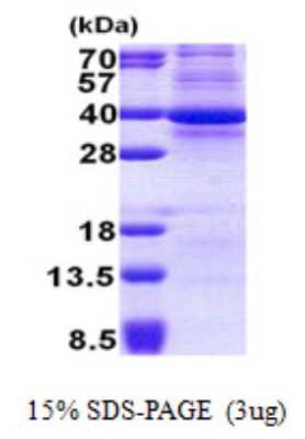 SDS-PAGE: Recombinant Human Cdk3 His Protein [NBP2-22973]