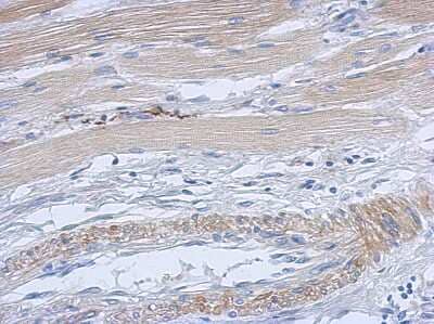 Immunohistochemistry-Paraffin: CDK4 Antibody [NBP1-31308]