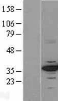 Western Blot: CDK4 Overexpression Lysate [NBL1-09039]