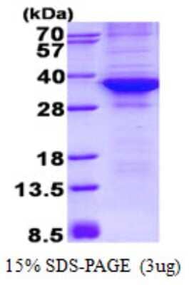 SDS-PAGE: Recombinant Human CDK4 His Protein [NBP2-22974]