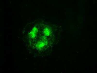 Immunocytochemistry/ Immunofluorescence: Cdk5 Antibody (OTI2H6) [NBP1-47692]