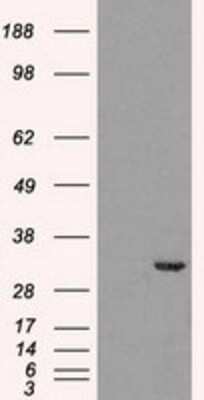 Western Blot: Cdk5 Antibody (OTI2H6) [NBP1-47692]