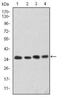 Western Blot: Cdk5 Antibody (4E4)BSA Free [NBP2-37602]