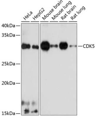 Western Blot: Cdk5 Antibody (7C8T10) [NBP3-15620]