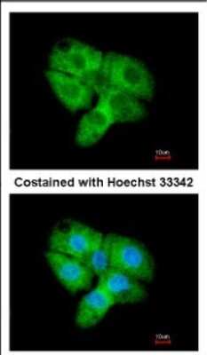Immunocytochemistry/ Immunofluorescence: Cdk5 Antibody [NBP2-15843]