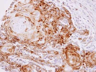 Immunohistochemistry-Paraffin: Cdk5 Antibody [NBP2-15843]