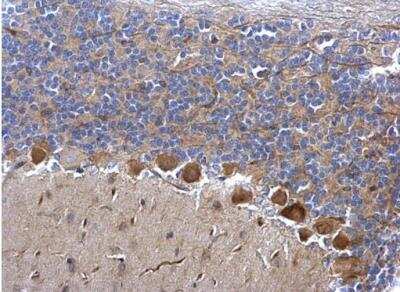 Immunohistochemistry-Paraffin: Cdk5 Antibody [NBP2-15843]
