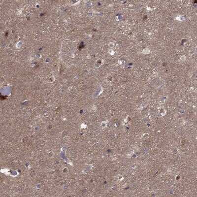 Immunohistochemistry-Paraffin: Cdk5 Antibody [NBP2-55870]
