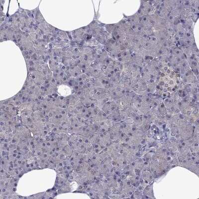 Immunohistochemistry-Paraffin: Cdk5 Antibody [NBP2-55870]