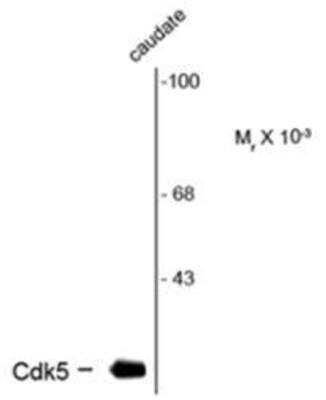 Western Blot: Cdk5 Antibody (1H3) [NBP1-47638]