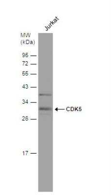 Western Blot: Cdk5 Antibody [NBP2-15843]