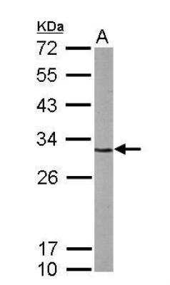 Western Blot: Cdk5 Antibody [NBP2-15843]