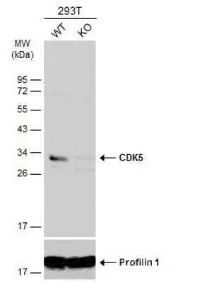 Western Blot: Cdk5 Antibody [NBP2-15843]